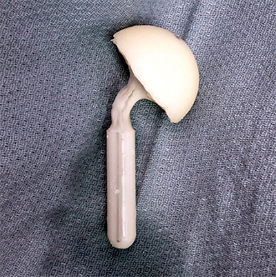 Prostalac Figure 3