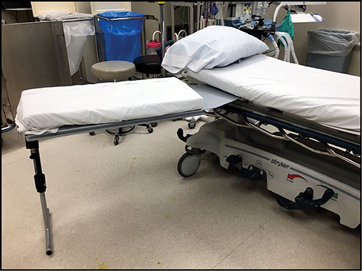 Effect of Stretcher-Based Hand Tables on Operating Room Efficiency at an Outpatient Surgery Center Figure 1