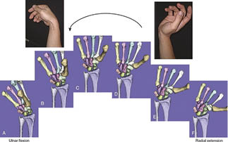 3D CT Wrist Figure 2