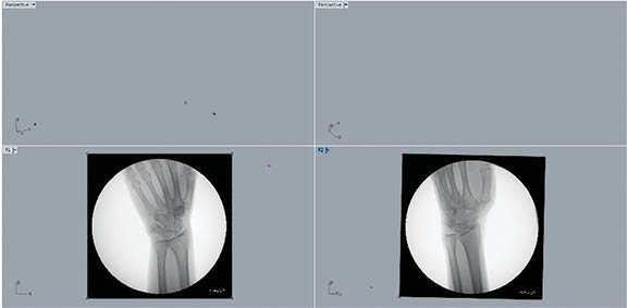 3D CT Wrist Figure 3