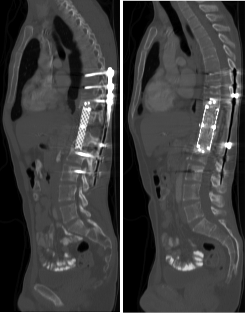 Radiation Sarcoma Figure 10